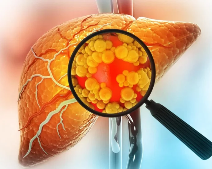 Latest Clinical Research on Reversing Fatty Liver Disease Naturally